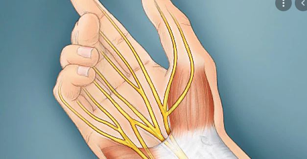 Photo of Guide to Carpal Tunnel Syndrome